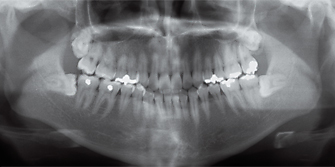 [Foto] Um FCR multifuncional