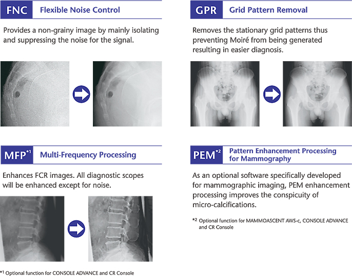 [Imagem] Processamento de imagem melhorado