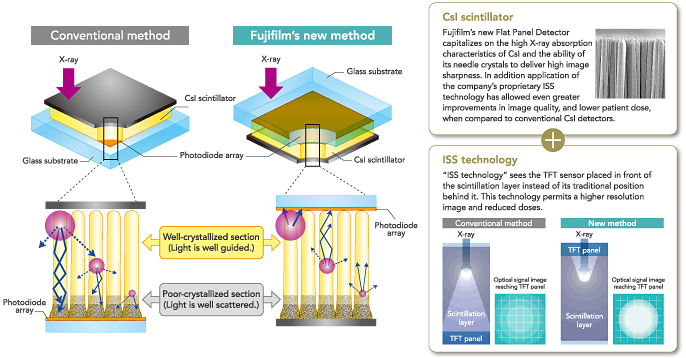 [Imagem] Uma excelente tecnologia propricia imagens mais nítidas e conversão de raios X mais eficiente